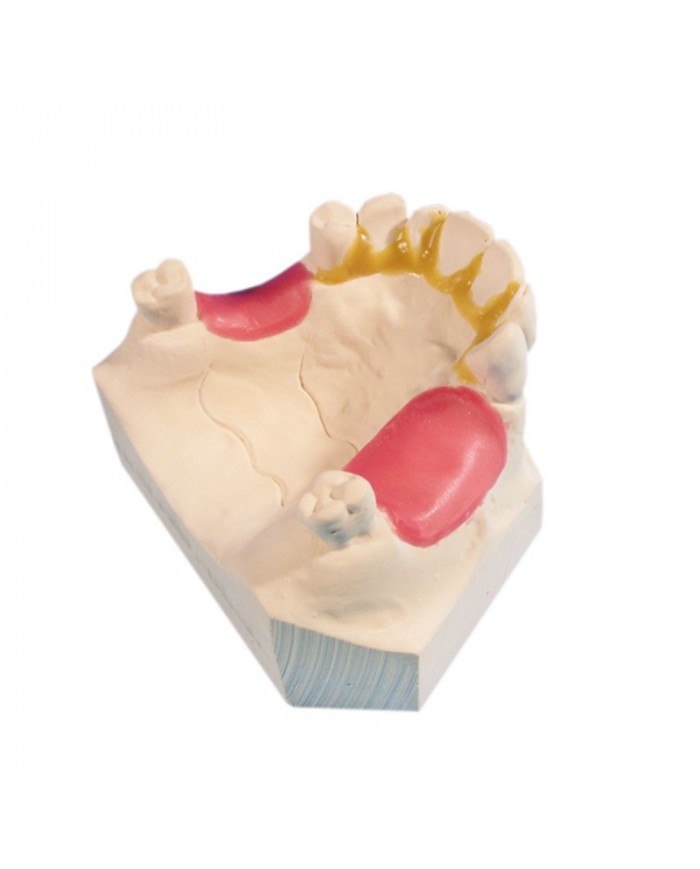 TECHNOWAX®-UNTERZIEHEN TECHNOWAX®-UNTERZIEHEN