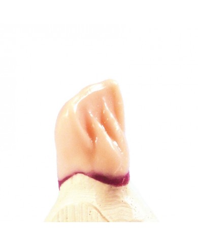 TECHNOWAX®-CERVICAL TECHNOWAX®-CERVICAL
