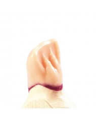TECHNOWAX®-CERVICAL TECHNOWAX®-CERVICAL