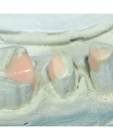 TECHNOWAX®-BLOCK C+B TECHNOWAX®-BLOCK C+B