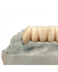 PROTECHNO®-C PROTECHNO®-C
