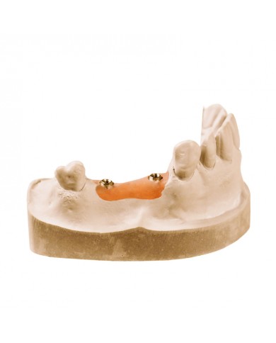 GINGIPRO-SIL GINGIPRO-SIL