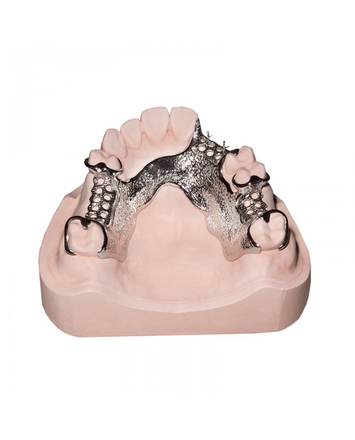 ALCOVEST RAPID ALCOVEST RAPID