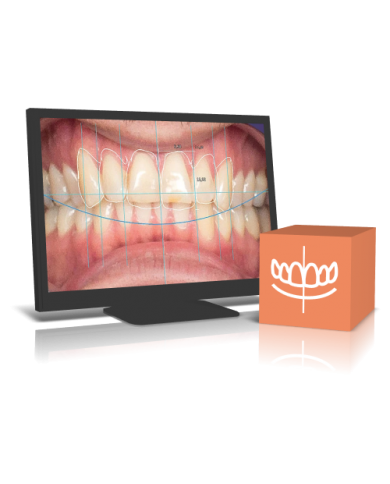 Smile creation module Smile creation module