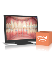 Modulo di creazione del sorriso