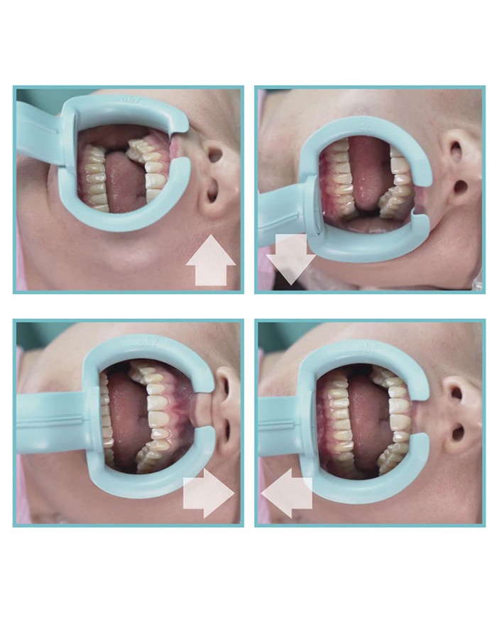 Oral BioFilter MONOUSO Oral BioFilter MONOUSO